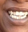 smiles4